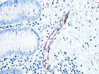 Western blot - CD62P/P-selectin Rabbit mAb (A4989)