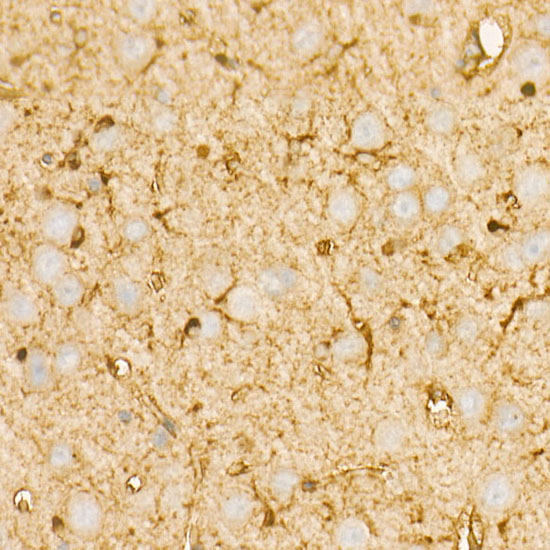 PI3 Kinase p85 alpha Rabbit monoclonal antibody