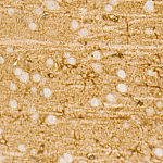 Western blot - PI3 Kinase p85 alpha Rabbit mAb (A4992)