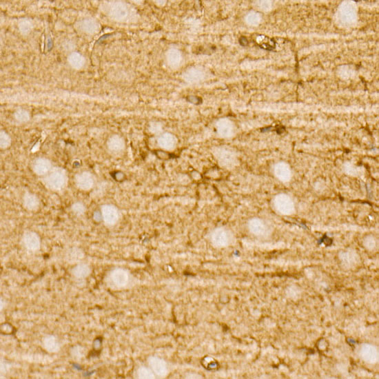 PI3 Kinase p85 alpha Rabbit monoclonal antibody