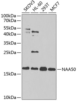NAA50 Rabbit polyclonal antibody