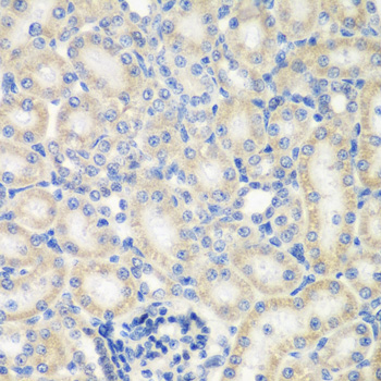 NAA50 Rabbit polyclonal antibody