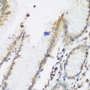 NAA50 Rabbit polyclonal antibody