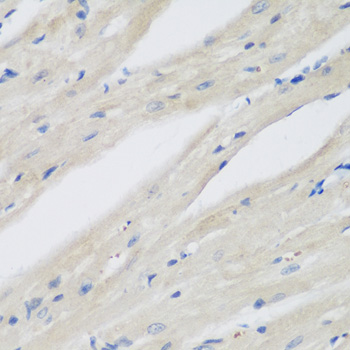 NAA50 Rabbit polyclonal antibody
