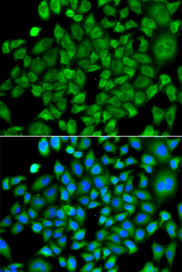 NAA50 Rabbit polyclonal antibody