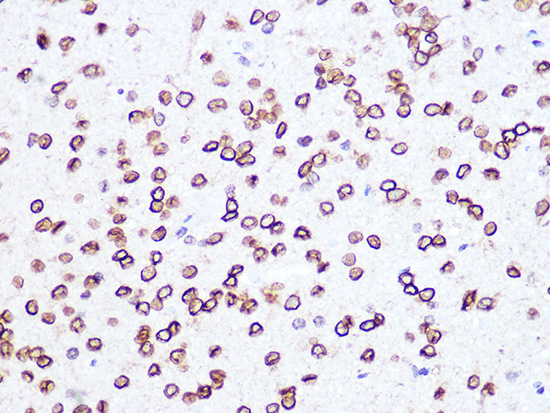 Lamin B2 Rabbit monoclonal antibody