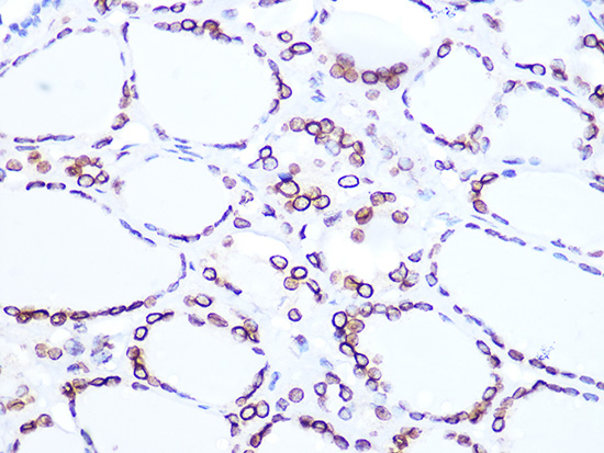 Lamin B2 Rabbit monoclonal antibody