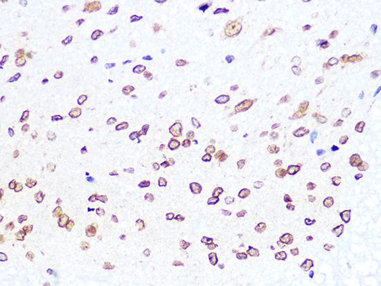 Lamin B2 Rabbit monoclonal antibody