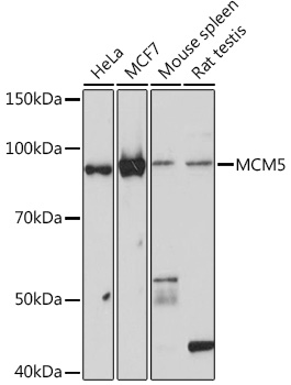 MCM5 Rabbit monoclonal antibody