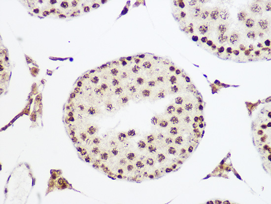 MCM5 Rabbit monoclonal antibody