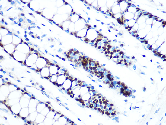 MCM5 Rabbit monoclonal antibody