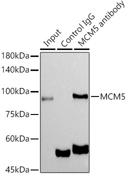 MCM5 Rabbit monoclonal antibody