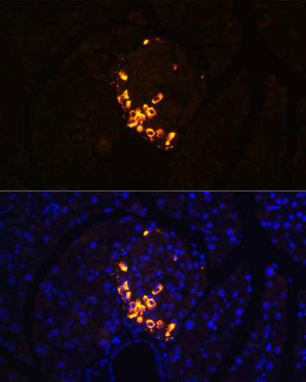 GLP-2 Rabbit monoclonal antibody