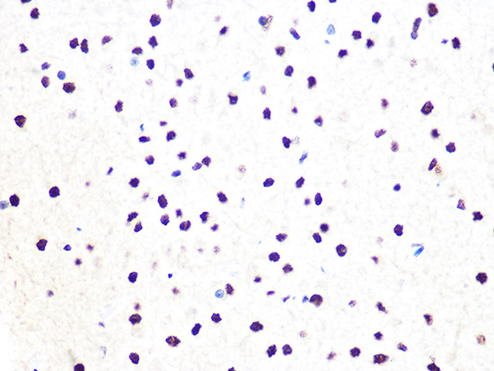 DDB1 Rabbit monoclonal antibody