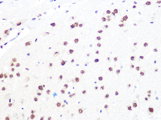 DDB1 Rabbit monoclonal antibody