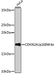 Western blot - CDKN2A/p16INK4a Rabbit mAb (A5025)