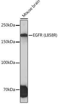EGFR (L858R) Rabbit monoclonal antibody