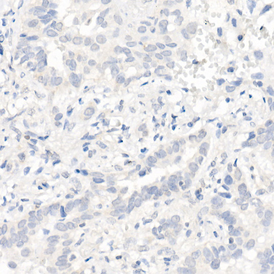 EGFR (L858R) Rabbit monoclonal antibody