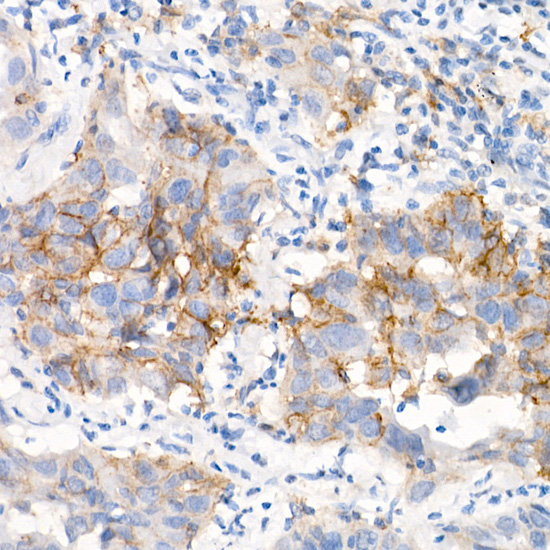 EGFR (L858R) Rabbit monoclonal antibody