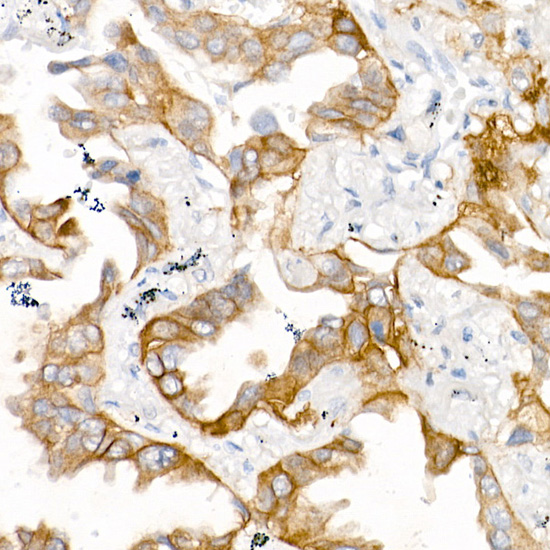 EGFR (L858R) Rabbit monoclonal antibody