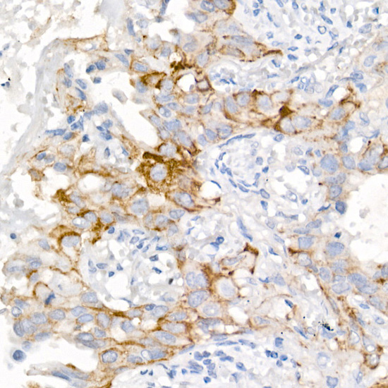 EGFR (L858R) Rabbit monoclonal antibody