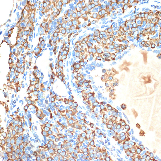 CYPOR Rabbit monoclonal antibody