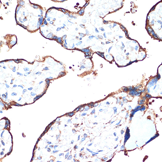 CYPOR Rabbit monoclonal antibody