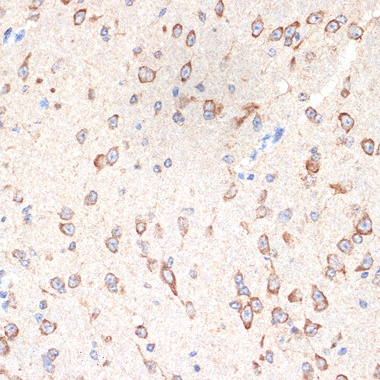 CYPOR Rabbit monoclonal antibody