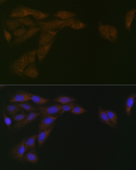 CYPOR Rabbit monoclonal antibody