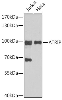 ATRIP Rabbit polyclonal antibody