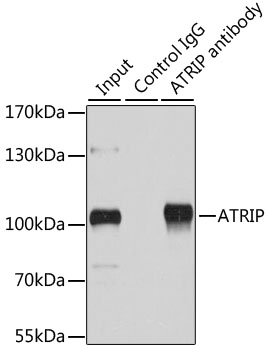 ATRIP Rabbit polyclonal antibody