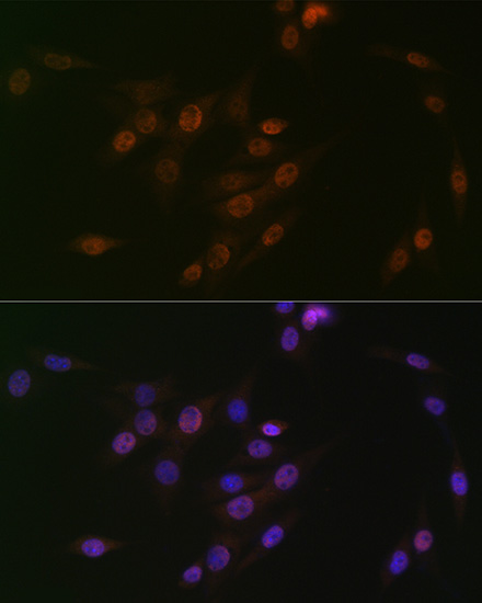 p38 MAPK Rabbit monoclonal antibody