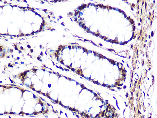 JNK1/JNK3 Rabbit monoclonal antibody