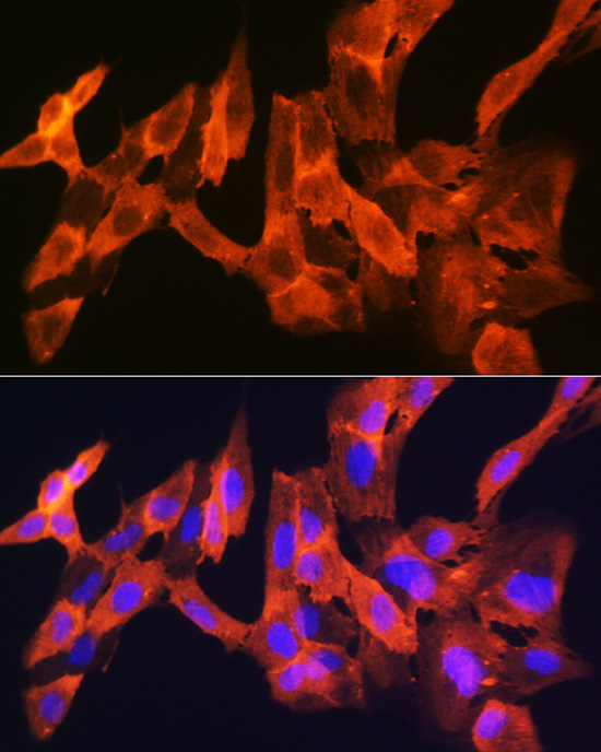 JNK1/JNK3 Rabbit monoclonal antibody