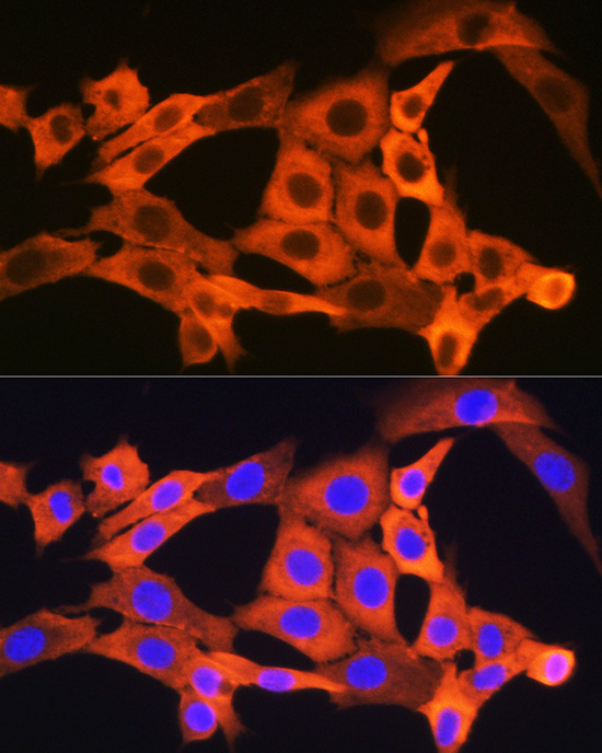 JNK1/JNK3 Rabbit monoclonal antibody