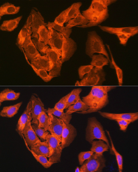 JNK1/JNK3 Rabbit monoclonal antibody