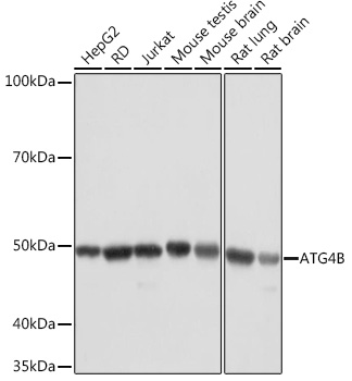 ATG4B Rabbit monoclonal antibody
