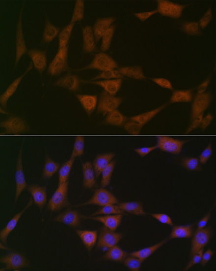 ATG4B Rabbit monoclonal antibody