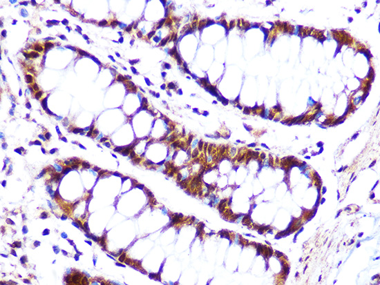 Cullin 4A Rabbit monoclonal antibody