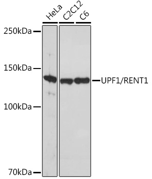 UPF1/RENT1 Rabbit monoclonal antibody