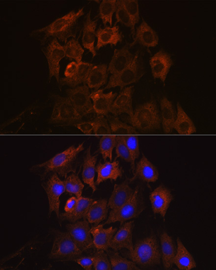 UPF1/RENT1 Rabbit monoclonal antibody