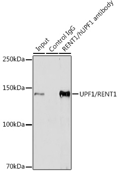 UPF1/RENT1 Rabbit monoclonal antibody