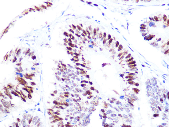 p60 CAF1 Rabbit monoclonal antibody