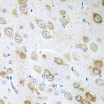 GFM1 Rabbit polyclonal antibody