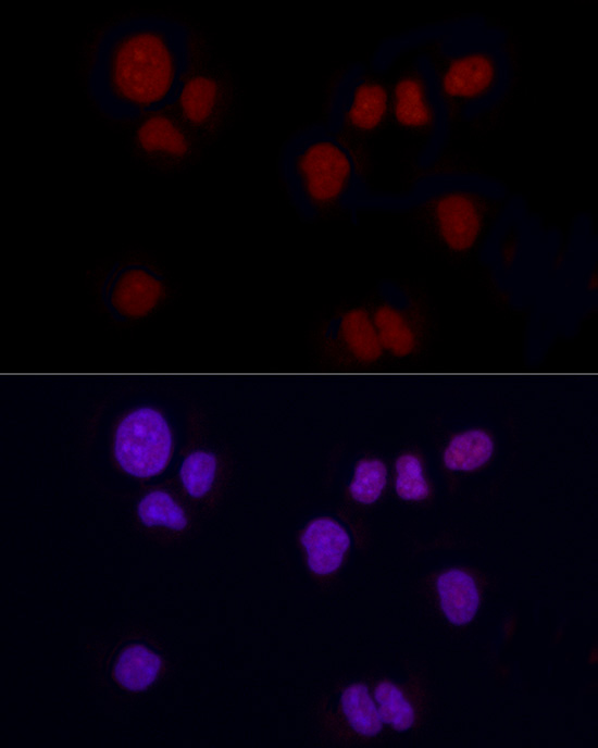 Brachyury Rabbit monoclonal antibody