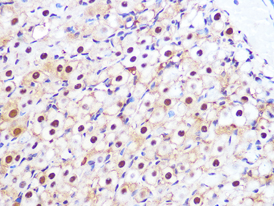 PSMA3 Rabbit monoclonal antibody