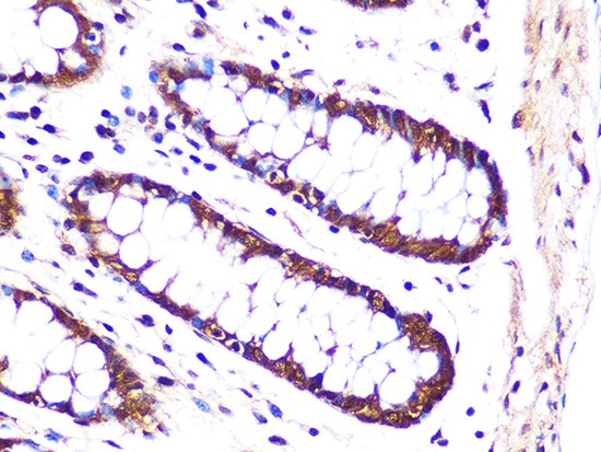 PSMA3 Rabbit monoclonal antibody