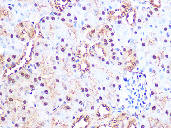 PSMA3 Rabbit monoclonal antibody