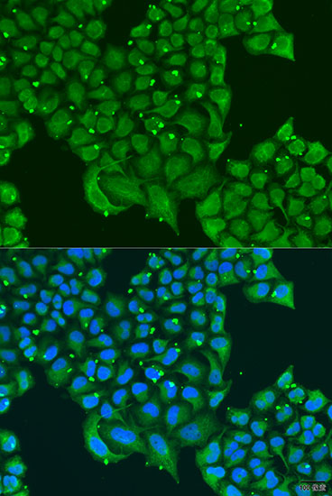 [KO Validated] ATPIF1 Rabbit polyclonal antibody