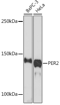 PER2 Rabbit monoclonal antibody